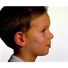3M Nexcare Steri-Strip Skin Closure