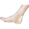 Mepilex Border Heel Dressing Application