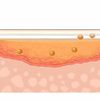 ADAPTIC Non-Adhering Dressing Absorbtion