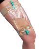 Core NelMed Urinary Bag Support-For-Thigh