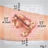 Buy  Enluxtra Humifiber Self Adaptive Wound Dressing