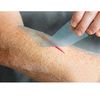 MedVance Adhesive Soft Silicone Tape