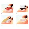  use of Covalon ColActive Plus Collagen Matrix Dressing