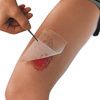 Smith & Nephew Cuticerin Impregnated Dressing