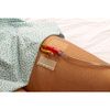 Dale Hold-n-Place Adhesive Patch