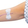 Grip-Lok Universal PICC Catheter Securement Device