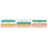 BSN Gel Dressing Dacc Technology binds Bacteria