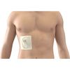PleurX Drainage Catheter Covered By Protective Dressing