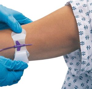 Grip-Lok Universal PICC Catheter Securement Device