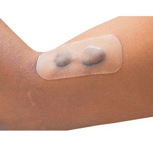 TopiGel Silicone Gel Dressing