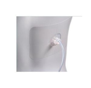 Uresil Tru-Fix Catheter Fixation System
