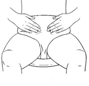 Nu-Hope Non-Adhesive Left Side Stoma Ileostomy Starter Set